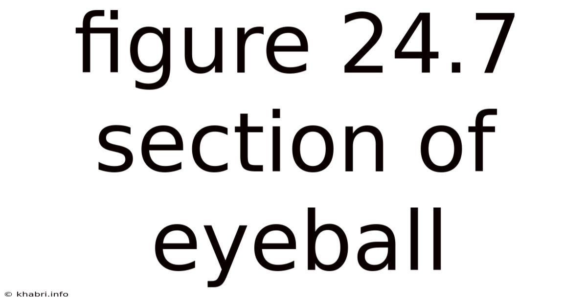 Figure 24.7 Section Of Eyeball