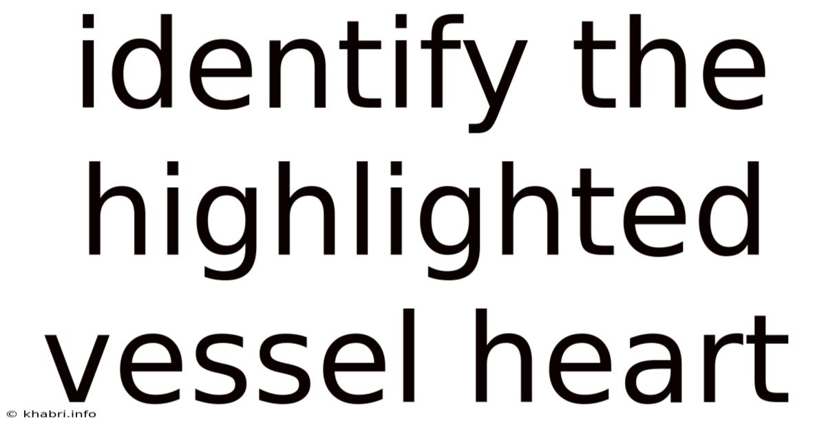 Identify The Highlighted Vessel Heart