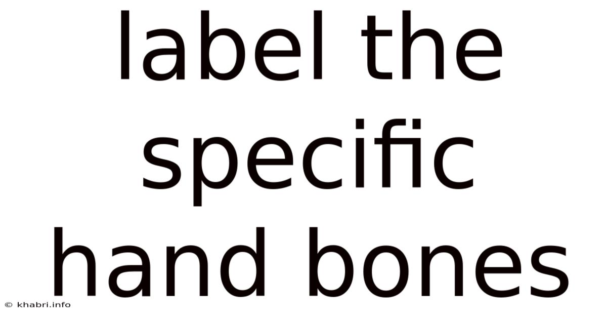 Label The Specific Hand Bones